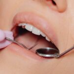 Black Triangle Teeth